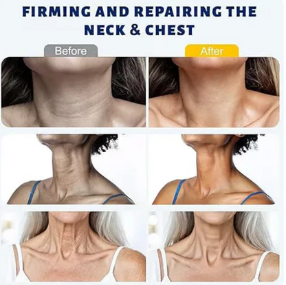 Plura™ Neck Firming Roller Cream – Smooth & Lift the Look of Your Neck in Weeks