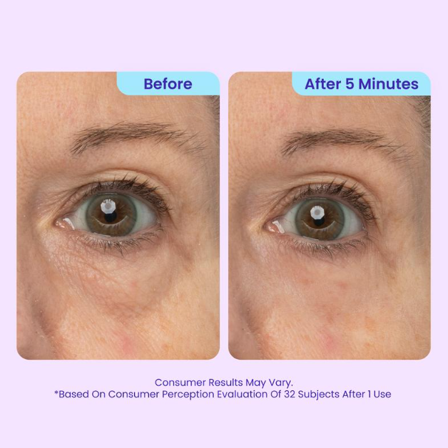 Plura™ 5-Minute Eye Lift