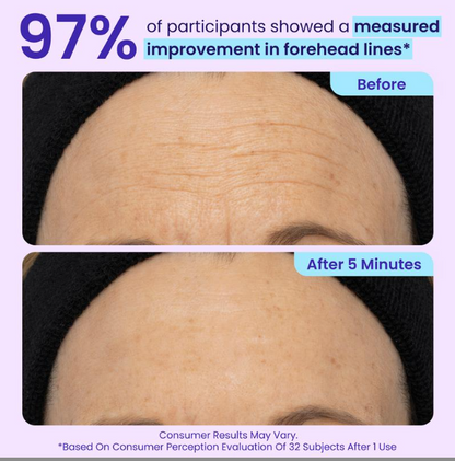 Plura™ 5-Minute Eye Lift