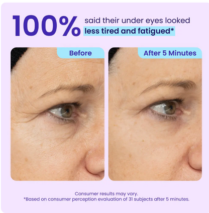 Plura™ 5-Minute Eye Lift