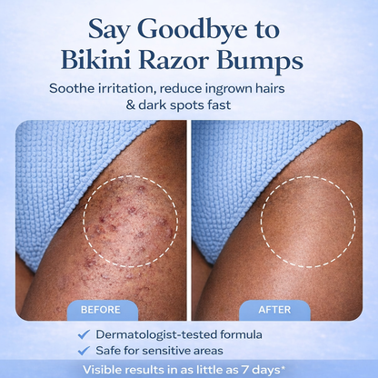 PLURA™ SmoothSkin Ingrown Hair Treatment